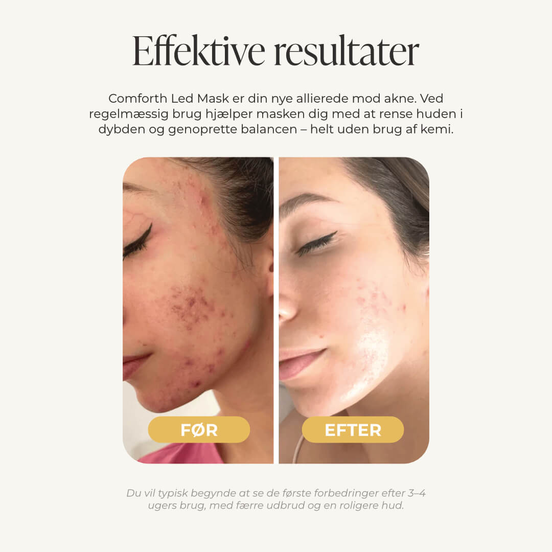 Comforth Light Pro - LED Maske